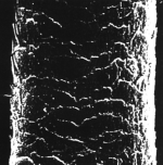 Cheveu vu au microscope